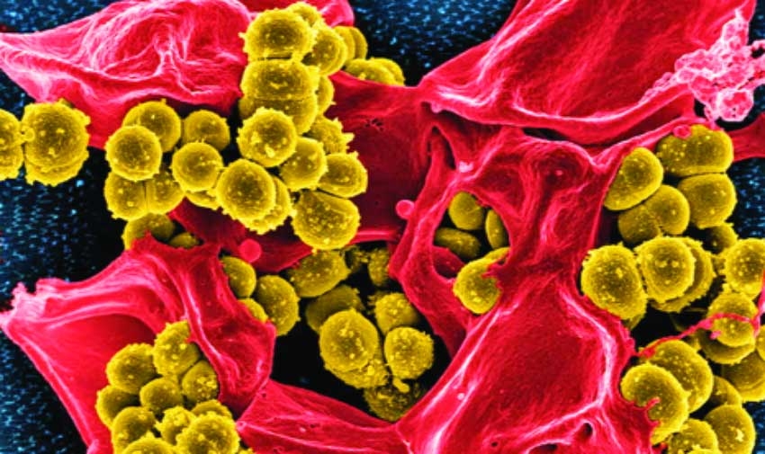 Uso de IA para predecir nuevos antibióticos